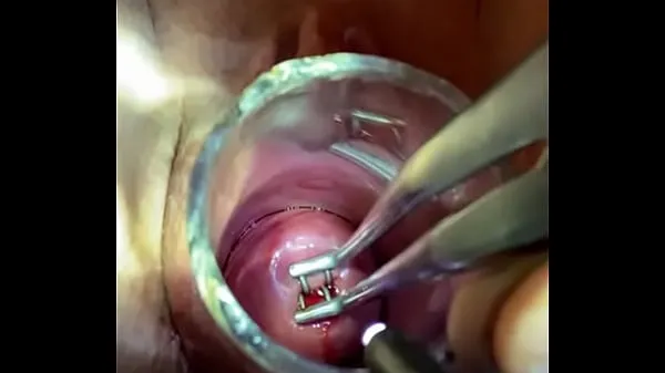 Watch Rosebud into uterus via endocervical speculum warm Clips